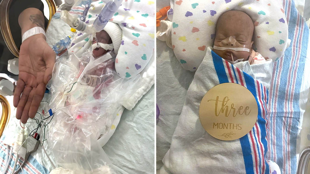 Essence being treated in the NICU at Cleveland Clinic Children's. 