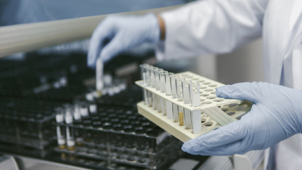 Fertility Conditions